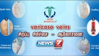 வெரிகோஸ் வெயின் என்றால் என்ன? | Vericose veins | Avishospitals | 03.06.2022