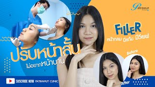 Review Ep.13 - ฟิลเลอร์คาง แก้คางตัด คางสั้น น้องเกรซ