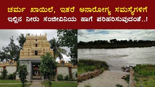 ಚರ್ಮ ಖಾಯಿಲೆ, ಇತರೆ ಅನಾರೋಗ್ಯ ಸಮಸ್ಯೆಗಳಿಗೆ ಇಲ್ಲಿನ ನೀರು ಸಂಜೀವಿನಿ ಹಾಗೆ ಪರಿಹಾರ ನೀಡುವುದಂತೆ..! - Japada Katte