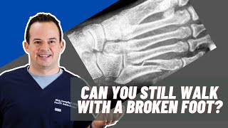 Can you walk on a broken foot? | Dr. Nick Campitelli