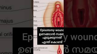 Episotomy wound ഉണങ്ങാൻ സമയം എടുക്കുന്നത് എന്ത് കൊണ്ട്#malayalam#baby#postpartum#happiness#pregnancy