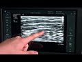 Xperius® Ultrasound System – Advanced Technology