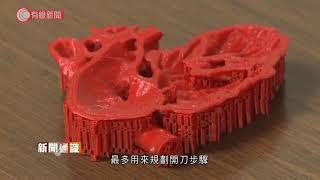 美國研發以海藻膠3D打印人類心臟　供外科醫生手術前試刀 - 20201126 - 港聞 - 有線新聞 CABLE News