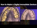 How to Do Digital Immediate Denture Design | Dental Lab education