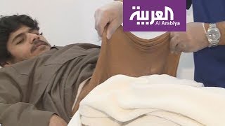 خالد الشاعري يتخلى عن لقب أضخم رجل على وجه الأرض