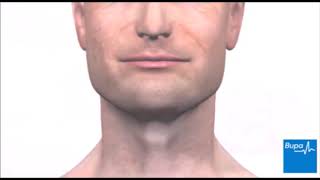 Upper GI endoscopy animation