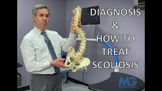 Scoliosis - Everything You Need To Know - Diagnosis \u0026 Treatment Options | Maragal Medical