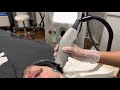 vbeam laser treatment demo for flawless results real time laser sound effects