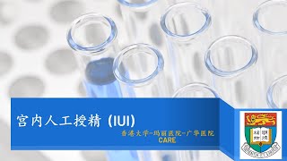 IUI輔導（普通話） - 宮內人工授精 IUI