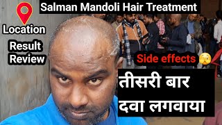 Salman Mandoli Hair Treatment Result | Salman mandoli location | Manoj Vishwakarma