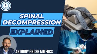 What is Spinal Decompression? Spine surgeon explains