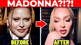 Plastic Surgeon Reacts to MADONNA's Cosmetic Surgery Transformation!