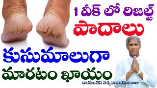 స్పీడ్ గా పాదాల పగుళ్లు తగ్గి, పువ్వుల్లా తయారు కావాలంటే ? | Foot cracks | Dr Manthena Satyanarayana