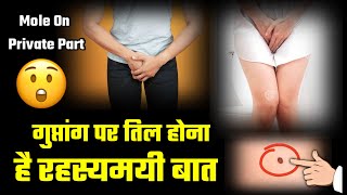 Guptang Par Til Hona Rahasyamayi Baat | Mole On Body Meaning | Learn Astrology | Sharir Par Til Hona