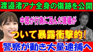 ついて暴露衝撃的! 渡邉渚アナ全身の傷跡を公開! 中居が行為に及んだ現場が!!! 警察が動き大量逮捕へ