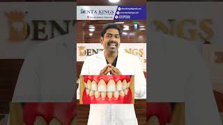 30 வயதிற்கு மேல் பற்களில் இடைவெளி ஏற்படுவது ஏன்? Why Teeth Gap Develops After 30 Age? | Denta Kings