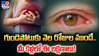 గుండెపోటుకు నెల రోజుల ముందే... మీ కళ్లలో ఈ లక్షణాలు! - TV9