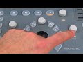 chison eco2 human ultrasound features keyboard functions