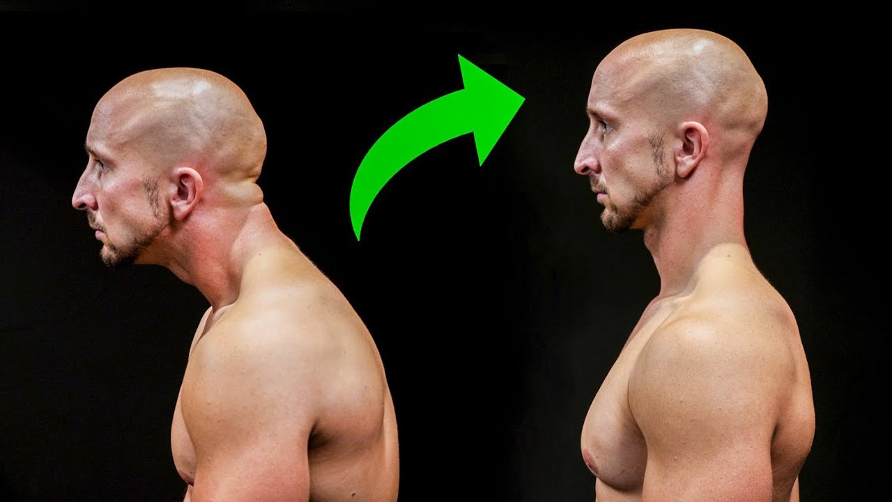 Fix Your Posture In Just 5 Minutes Youtube