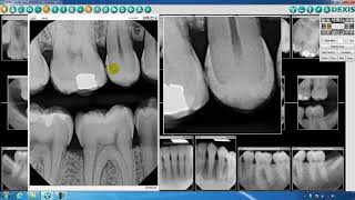 DEXIS™ Imaging Suite Toolbar Overview - Part Two