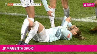 Autsch, das tat weh! | FLYERALARM Frauen-Bundesliga | 1. FFC Turbine Potsdam