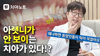 🤔과개교합? 치의박박사가 알려주는 과개교합