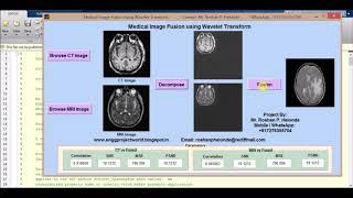 Medical Image Fusion using Wavelet Transform Matlab Project Source Code | Image Fusion Using DWT