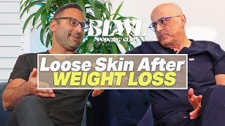 How To Deal With Loose Skin After Weight Loss?