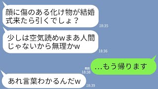 【LINE】兄の結婚式に生まれつき顔に傷のある私が行くと兄嫁と両親「化け物の席などない！帰れ！」兄嫁「空気読めよw」→言われた通り兄と一緒に帰ってあげた結果www