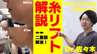 糸リフトでここまで上がる！糸リフト”Anchor DX double”を解説！【Dr.佐々木の美容講座】