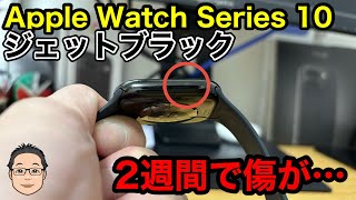 Apple Watch Series 10のジェットブラック、使用2週間で傷が…【2週間使用レビュー】