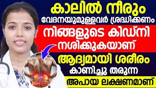 കാലിൽ നീരും വേദനയുമുള്ളവർ ശ്രദ്ധിക്കണം | കിഡ്‌നി തകരാറിലാണെന്ന് കാണിക്കുന്ന ലക്ഷണങ്ങളാണ് | Dr.Juhi