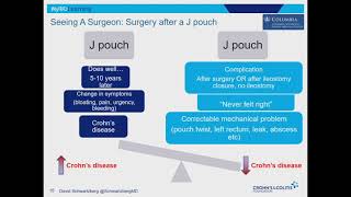 Exploring Surgery Options for Crohn's Disease and Ulcerative Colitis