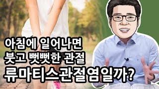 [이뮨닥터스] 아침에 붓고 뻣뻣한 관절, 류마티스관절염일까?