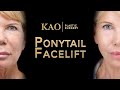 Ponytail Facelift? Facial Rejuvenation Surgery Before and After