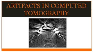 ARTIFACTS IN COMPUTED TOMOGRAPHY / CT ARTIFACTS / RADIOLOGY 2.0....