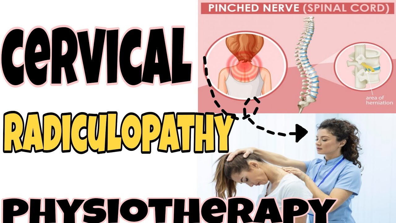 Cervical Radiculopathy Overview||Cervical Radiculopathy||Pinched Nerve ...