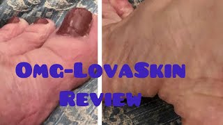 LovaSkin Review-OMG