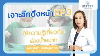 Narada Expert Talk ศัลยกรรมดึงหน้า Ep.3 ร่องน้ำหมาก