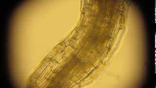 Pythium zoospores on bentgrass roots