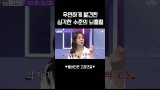 의사의 뇌출혈 썰💥