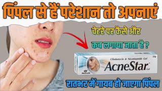 Acnestar Gel  के लाभ और उपयोग करने का तरीका - Acnestar Gel | Benefits \u0026 Uses in Hindi.