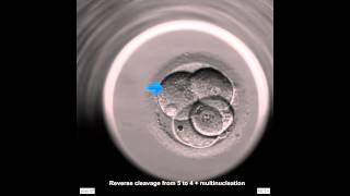 EmbryoScope Embryo Development - Unusual Division