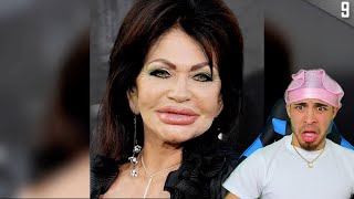 CRAZIEST PLASTIC SURGERY FAILS!! *SHE LOOKS LIKE AN ALIEN* (Before and After) *REACTION*