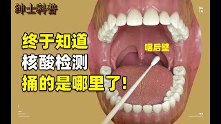 3  做了那麼多次核酸檢測，你知道捅的是哪裡嗎？