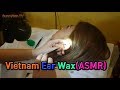 Vietnam Ear Cleaning, so Amazing!(Full Ver.)