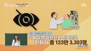 안질환의 3대장 ▶백내장 녹내장 황반변성◀ 실명을 유발할 수 있는 질환?! | 산전수전 여고동창생 35 회