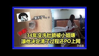 34年沒洗肚臍被小姐嫌 讓他決定清了過程還PO上網