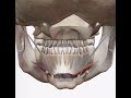 オトガイ舌骨筋・おとがいぜっこつきん／musculus geniohyoid