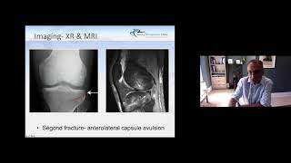 May 2020: "The Ruptured ACL" Child to Adult and OA Knee Evidence Based Treatment